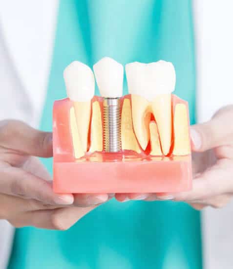 Dental Implants in Albuquerque